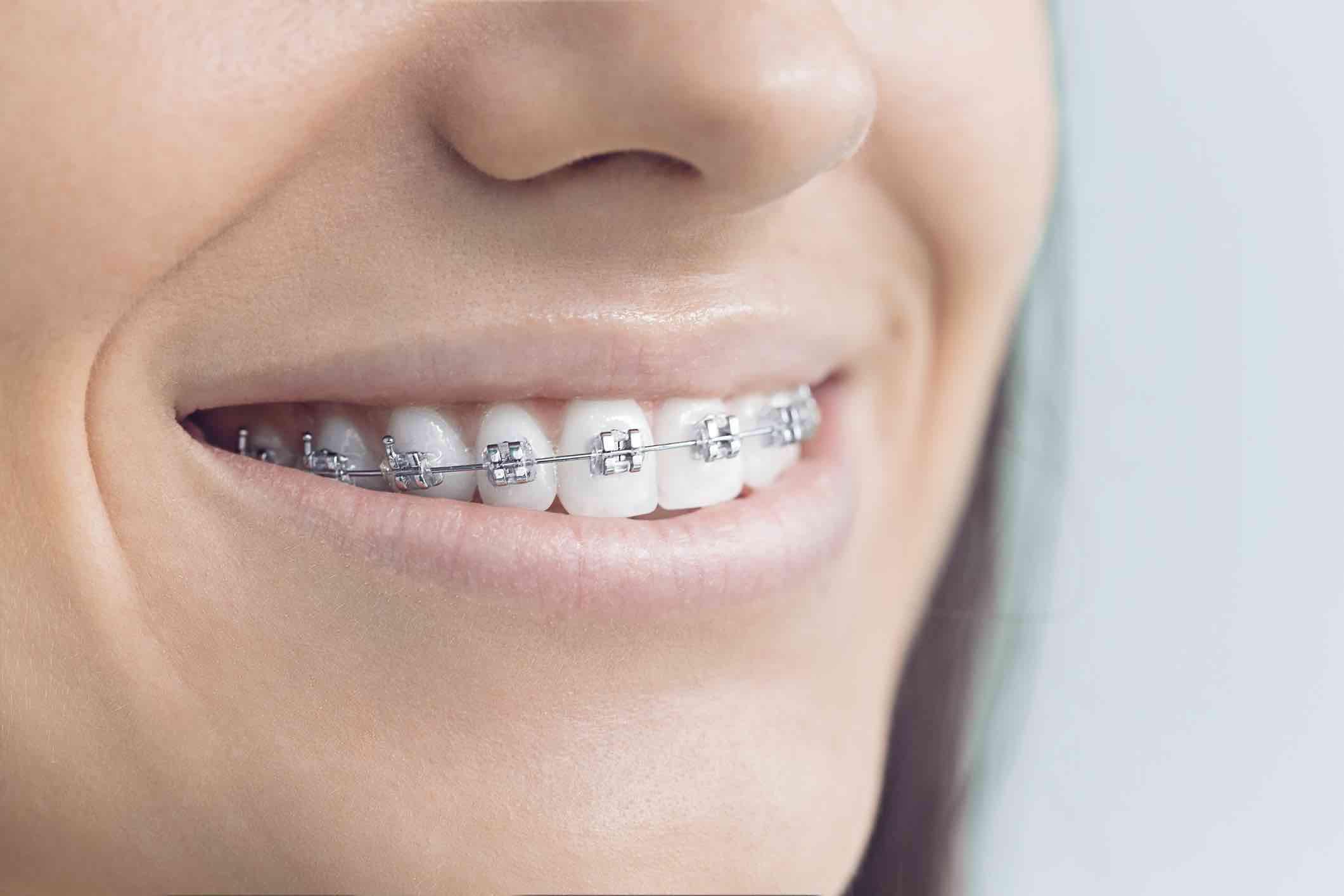 https://oskodental.pl/#